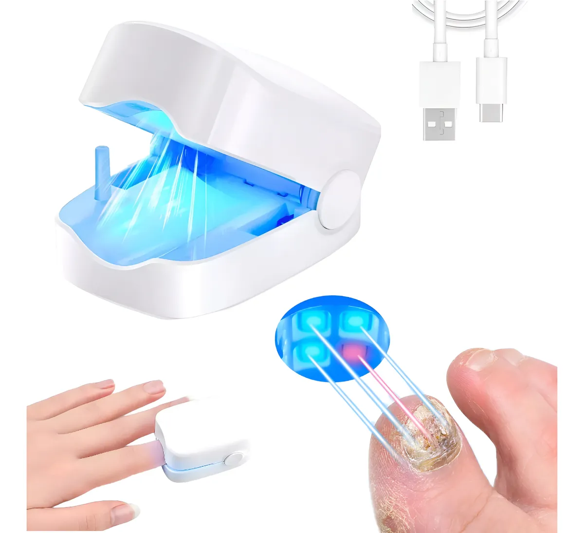 Láser Antihongos Para Uñas Con Luz LED